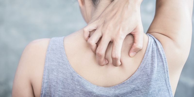 A person scratching their dry, itch back.